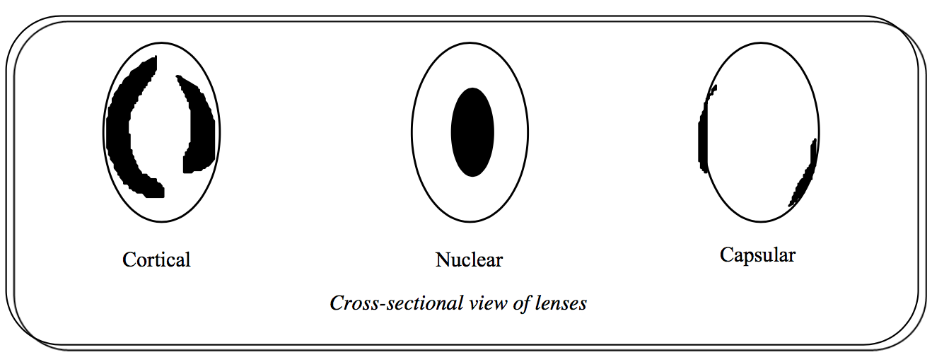 Cortical