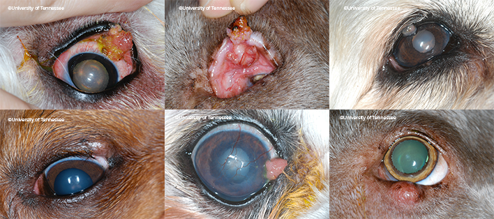 Grid of Eyelid Masses