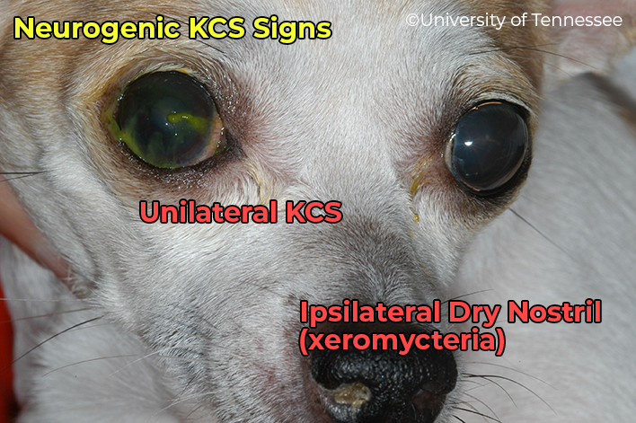 Neurogenic KCS Appearance with Xeromycteria (dry nostril)